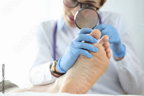 Dermatologist examining toenail with magnifying glass closeup