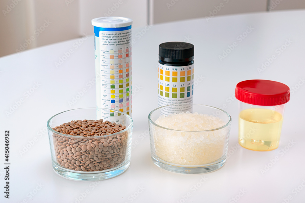 Lentils and cats pearl litter for urinalysis. Comparison between