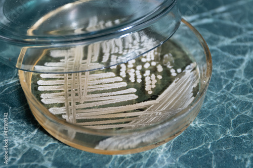 An open petri dish with white colonies of actinomycete bacteria that secrete antibiotics