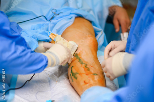 Preparing the patient for phlebectomy surgery. Surgical field marking photo
