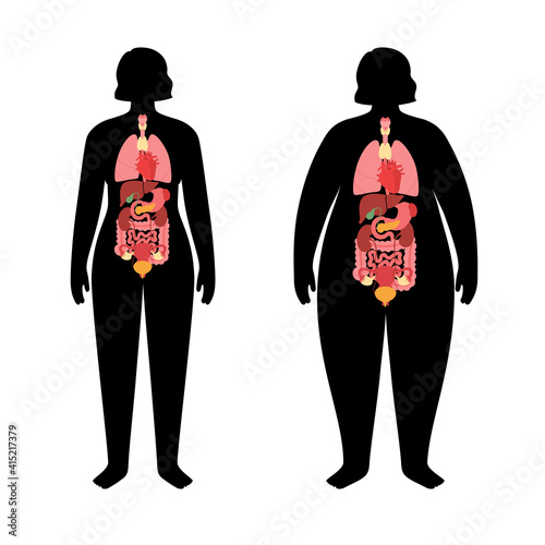 Organs in obese human body