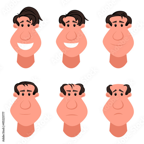 Information chart showing types and stages of hair loss for men. Bolding head from full hair cover to a final stage of baldness