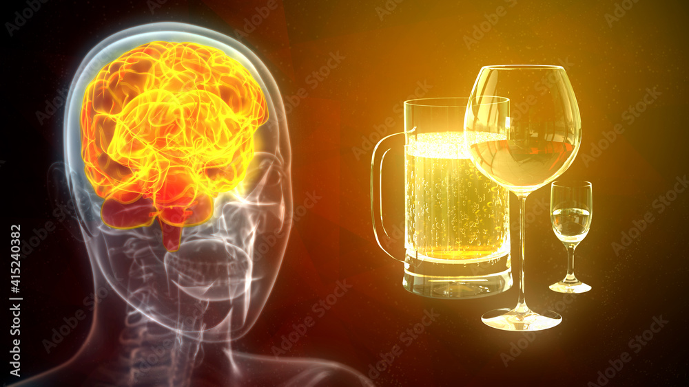cg healthcare 3d illustration, brain affected by alcohol - obrazy, fototapety, plakaty 