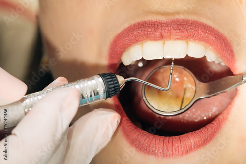 Professional dentist working with gloves with patients teeth with an open mouth. The concept of oral help. Dentist examining teeth with medical instruments. Dental hygiene procedure