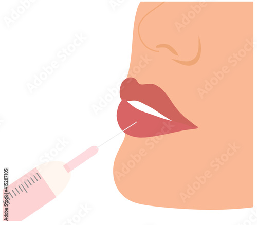 Filler injection concept. Serum syringe injects filler to lip of woman vector illustration. Plastic, aesthetic cosmetology beauty treatment concept
