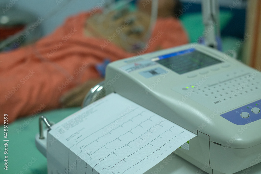 Electrocardiogram in the hospital, analyzing ECG electrocardiogram of patient in hospital. Electrocardiogram in the hospital, analyzing ECG electrocardiogram of patient in hospital.