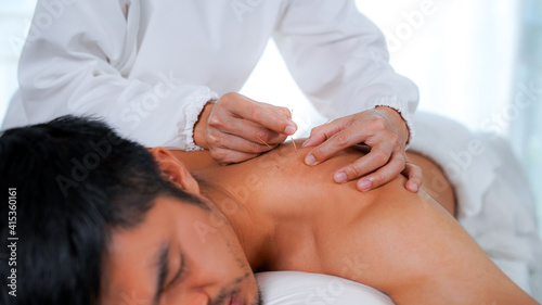 Acupuncture needles on the back of men to treat back pain