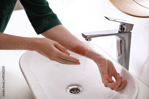 Quadro su tela Woman putting burned hand under running cold water indoors, closeup