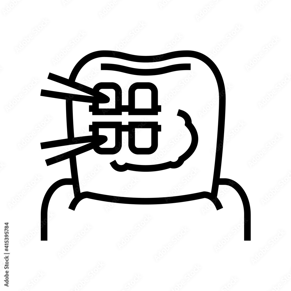 installation tooth braces line icon vector. installation tooth braces sign. isolated contour symbol black illustration installation tooth braces line icon vector. installation tooth braces sign. isolated contour symbol black illustration