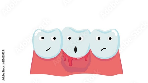 Flat vector animation for dentistry.
The teeth of the characters show their emotions, one got sick, his gums are bleeding, he is in a panic, if not treated, this leads to periodontal disease.