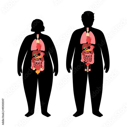 Organs in obese human body