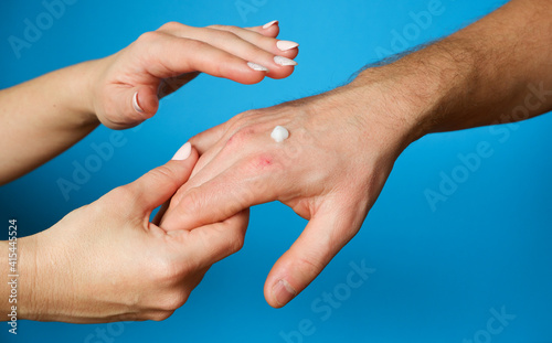 Hand skin care. The woman put the cream on man's weathered hand.