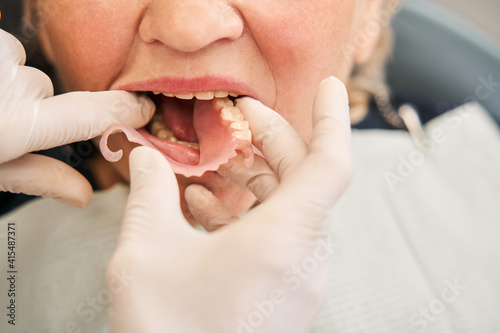 Dentist putting artificial teeth to patient mouth