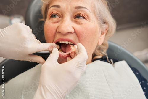 Woman having artificial teeth from her dentist