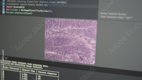 2.57 Real Neural Network Machine Learning Analyzes Colorectal Cancer Biopsy MSIMUT MSS Prediction