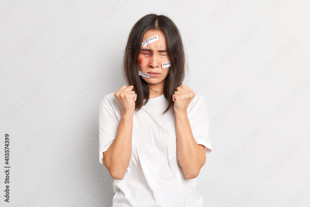 Patient insulted woman clenches fists tries to control emotions gets beating from drunk husband has bruises on face clenches fists isolated over wite background. Pressure crime abusement concept Patient insulted woman clenches fists tries to control emotions gets beating from drunk husband has bruises on face clenches fists isolated over wite background. Pressure crime abusement concept