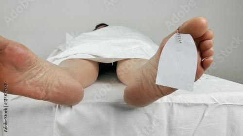 close up of the feet of dead body after autopsy possibly deceased from covid-19