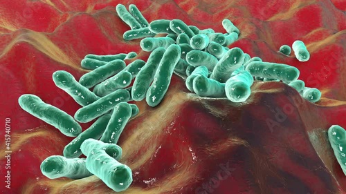 Cutibacterium acnes bacteria, formerly Propionibacterium acnes, 3D animation. Bacteria found in hair follicles and associated with the development of acne, chronic blepharitis, and endophthalmitis