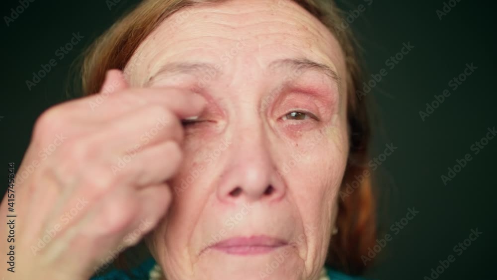 Old red haired woman applies cream on her upper eyelid. Applying anti aged cosmetics.