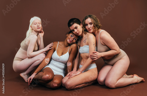 Group of multiethnic women with different kind of skin posing together in studio. Concept about body positivity and self acceptance