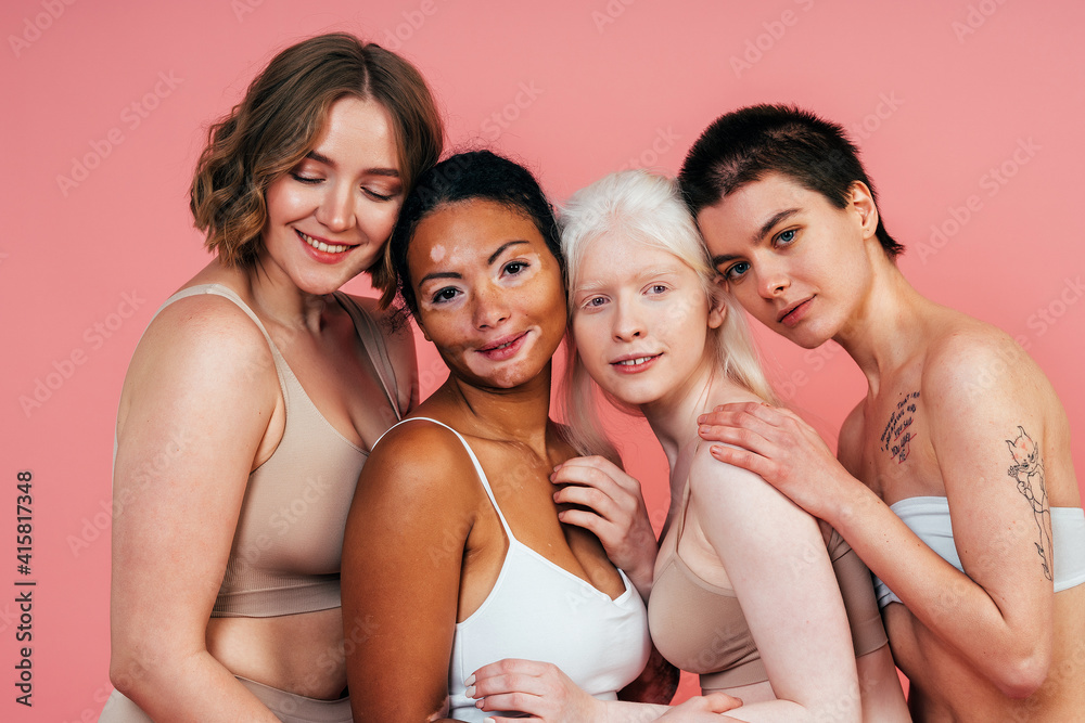 Fototapeta premium Group of multiethnic women with different kind of skin posing together in studio. Concept about body positivity and self acceptance