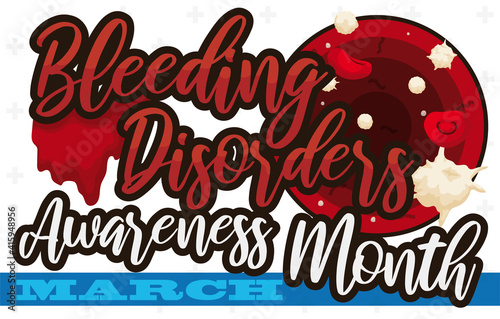 Blood Clotting Cells and Sign for Bleeding Disorders Awareness Month, Vector Illustration