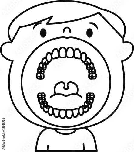 子供　歯列　口の中　イラスト