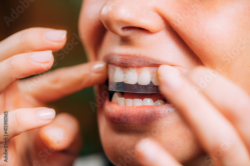 Woman Using Whitening Stipes or Whitestrips. Whitening Teeth at Home. photo