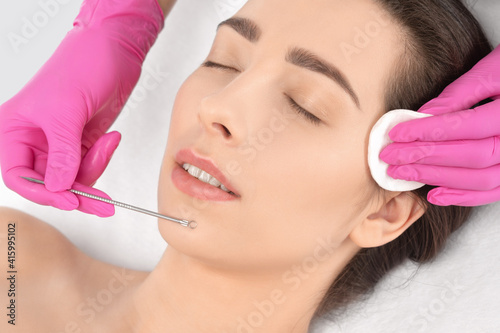A procedure for cleansing the skin of the face from blackheads and acne. Cosmetologist treats problematic skin of a young woman's face in a beauty salon. Aesthetic cosmetology and makeup concept.