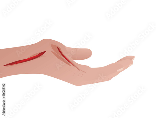 Hand blood injury. vector illustration