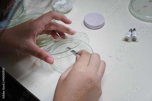 The hand was holding the filter paper tongs onto the prepared petri dish. Tests for the ability to inhibit microorganisms or bacteria in petri dishes by Disc diffusion techniques.