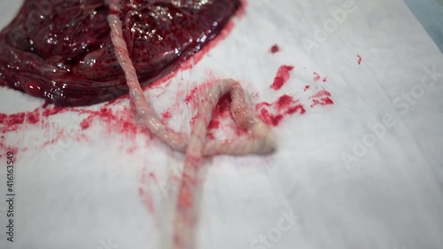 A closeup of a human placenta on bedsheets in the hospital shot in 4K photo