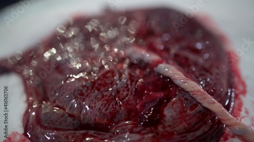 A closeup of a human placenta on bedsheets in the hospital shot in 4K