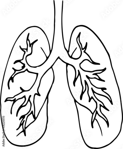 Illustration of lugs 