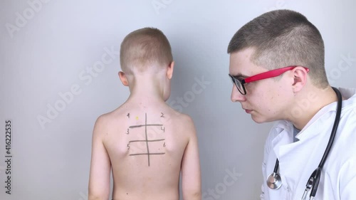 An allergist in the laboratory conducts an allergy prick-test. Skin test for household, food, epidermal allergic reactions. The test is performed on the patient's back. Child at a doctor's appointment photo