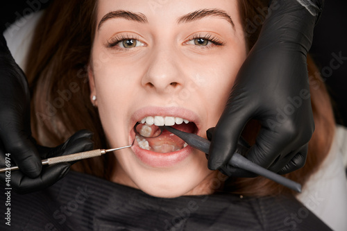 Close up of dentist examining young woman teeth with dental mirror and explorer. Patient with open mouth having prophylactic examination in dental clinic. Concept of dentistry and dental care.