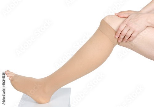 Compression garments for the treatment of lipoedema and lymphoedema.Lymphedema management: Wrapping leg using multilayer bandages to control Lymphedema. Part of complete decongestive therapy (cdt