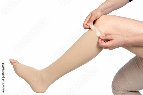 Compression garments for the treatment of lipoedema and lymphoedema.Lymphedema management: Wrapping leg using multilayer bandages to control Lymphedema. Part of complete decongestive therapy (cdt