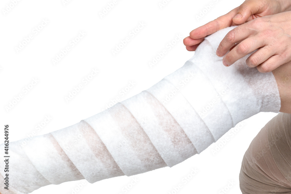 Lymphedema management Wrapping Lymphedema leg using multilayer