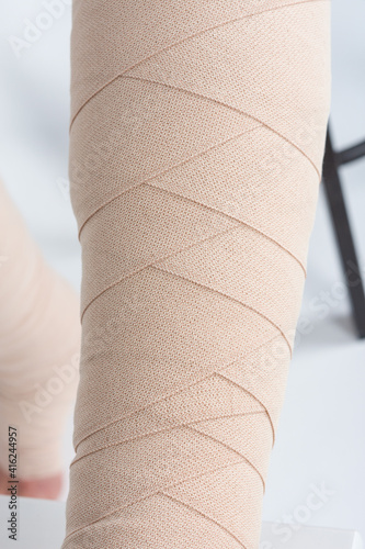 Lymphedema management: Wrapping leg using multilayer bandages to control Lymphedema. Part of complete decongestive therapy (cdt) and manual lymphatic drainage (MLD)
