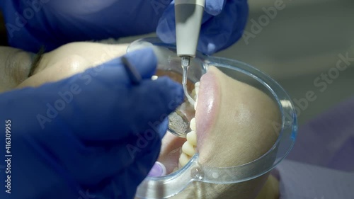 teeth alignment in the clinic