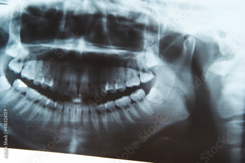 x image of teeth