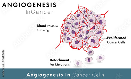 Cancer Cell angiogenesis vector graphic design  photo
