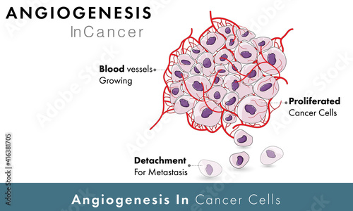 Cancer Cell angiogenesis vector graphic design 