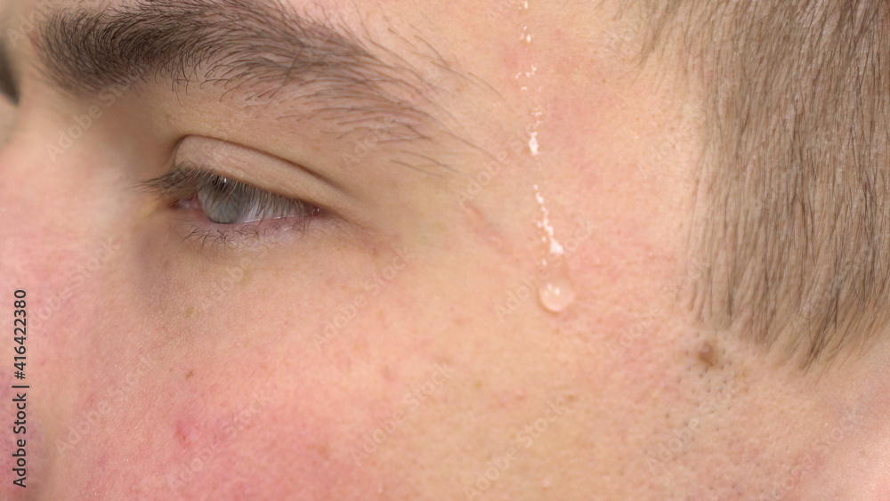 The young man was sweating because of the heat. The man felt hot in the stuffy room. Sweat flows on the head close-up. The young man was sweating because of the heat. The man felt hot in the stuffy room. Sweat flows on the head close-up.