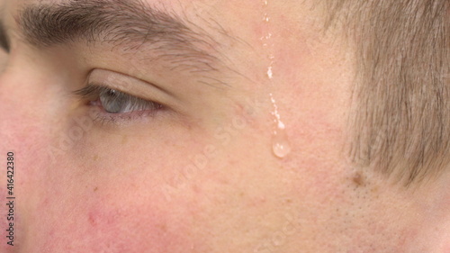 The young man was sweating because of the heat. The man felt hot in the stuffy room. Sweat flows on the head close-up.