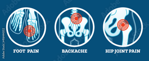 Body Pain. Icons Set. Pain in Foot, Backache and Hip Joint.