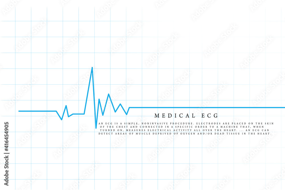 Heart with cardiogram - 2D illustration Heart with cardiogram - 2D illustration