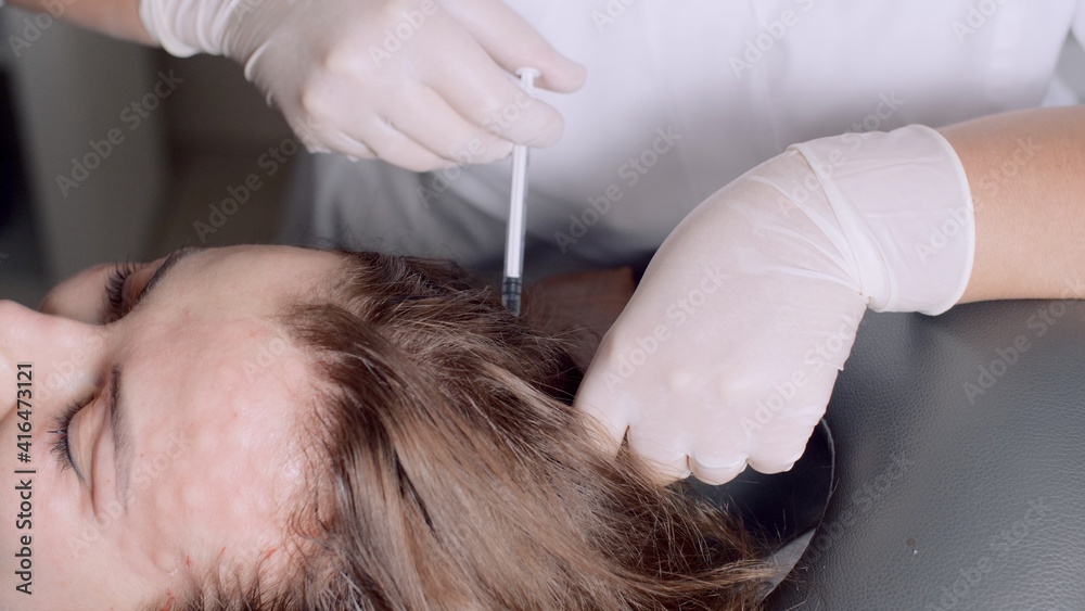 Cosmetological procedure mesotherapy of the head. Doctor's hands in white protective medical gloves put injections into the scalp of a woman. Many syringes. Mesotherapy treatment. Cosmetological procedure mesotherapy of the head. Doctor's hands in white protective medical gloves put injections into the scalp of a woman. Many syringes. Mesotherapy treatment.