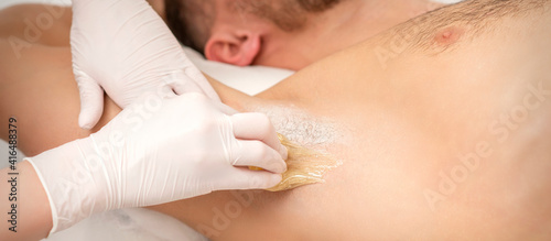 Close up of hands in gloves of beautician waxing young male armpit with sugar paste in hair removal salon